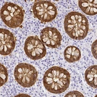 Immunohistochemical staining of human colon shows strong cytoplasmic positivity in glandular cells.