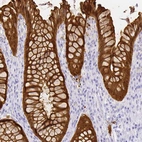 Immunohistochemical staining of human rectum shows strong cytoplasmic positivity in glandular cells.