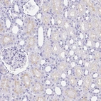 Immunohistochemical staining of human kidney shows negative to very weak positivity in cells in tubules.