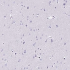 Immunohistochemical staining of human cerebral cortex shows no positivity in neurons as expected.