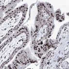 Anti-SART1 Antibody