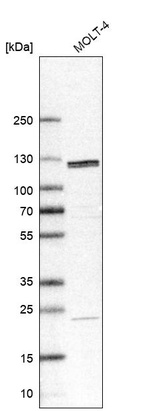 Western blot analysis in human cell line MOLT-4.