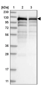 Lane 1: Marker [kDa] 230, 130, 95, 72, 56, 36, 28, 17, 11_br/_Lane 2: Human cell line RT-4_br/_Lane 3: Human cell line U-251MG sp