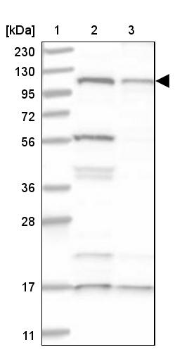Anti-SART1 Antibody