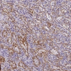 Immunohistochemical staining of human spleen shows high expression.