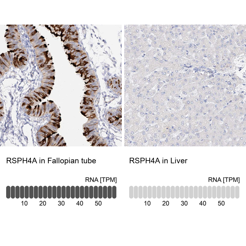 Anti-RSPH4A Antibody