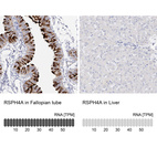 Anti-RSPH4A Antibody