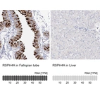 Anti-RSPH4A Antibody