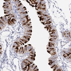 Immunohistochemical staining of human fallopian tube shows high expression.