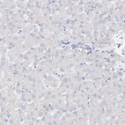 Anti-RSPH4A Antibody