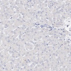 Immunohistochemical staining of human liver shows low expression as expected.