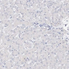 Immunohistochemical staining of human liver shows low expression as expected.
