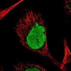 Immunofluorescent staining of human cell line A-431 shows localization to nucleus.