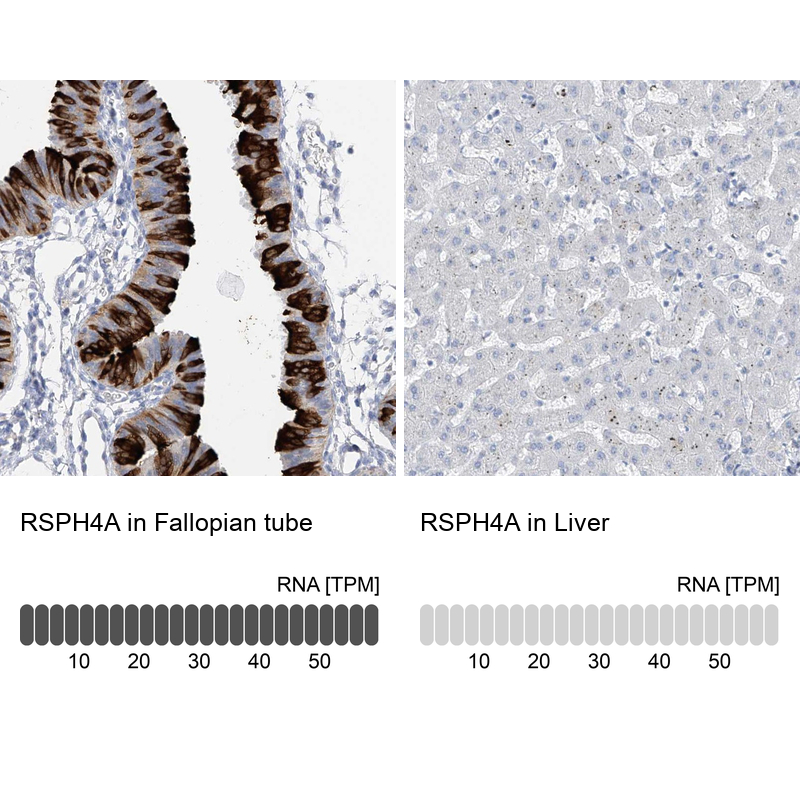 Anti-RSPH4A Antibody
