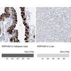 Anti-RSPH4A Antibody