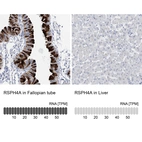 Anti-RSPH4A Antibody