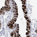 Immunohistochemical staining of human fallopian tube shows high expression.