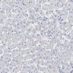 Anti-RSPH4A Antibody