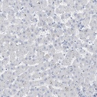 Immunohistochemical staining of human liver shows low expression as expected.