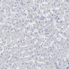 Immunohistochemical staining of human liver shows low expression as expected.