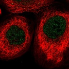 Immunofluorescent staining of human cell line A-431 shows localization to nucleoplasm.