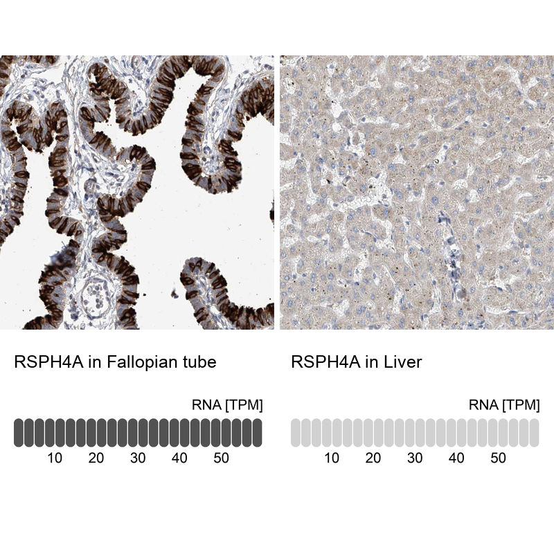 Anti-RSPH4A Antibody