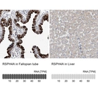 Anti-RSPH4A Antibody