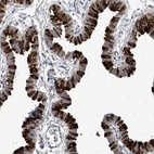 Immunohistochemical staining of human fallopian tube shows high expression.