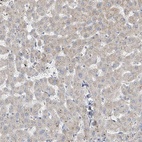 Immunohistochemical staining of human liver shows low expression as expected.