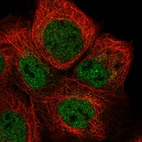 Immunofluorescent staining of human cell line A-431 shows localization to nucleoplasm.