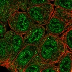 Anti-EPAS1 Antibody