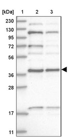 Lane 1: Marker [kDa] 230, 130, 95, 72, 56, 36, 28, 17, 11_br/_Lane 2: Human cell line RT-4_br/_Lane 3: Human cell line U-251MG sp