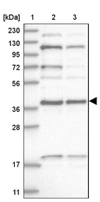Lane 1: Marker [kDa] 230, 130, 95, 72, 56, 36, 28, 17, 11_br/_Lane 2: Human cell line RT-4_br/_Lane 3: Human cell line U-251MG sp
