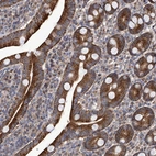 Anti-EFCAB2 Antibody