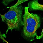Immunofluorescent staining of human cell line U-2 OS shows localization to plasma membrane, cytosol & mitochondria.