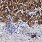 Anti-EFCAB2 Antibody