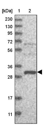 Lane 1: Marker [kDa] 230, 130, 95, 72, 56, 36, 28, 17, 11_br/_Lane 2: Human cell line RT-4