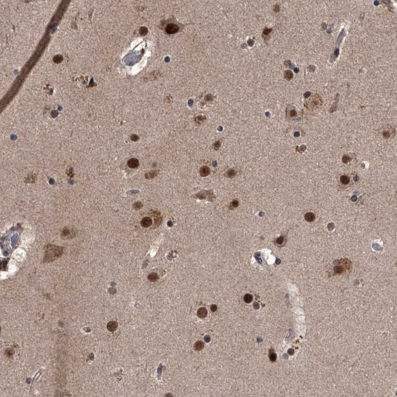 Anti-ZNF518B Antibody