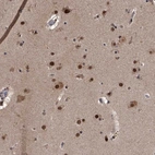Anti-ZNF518B Antibody