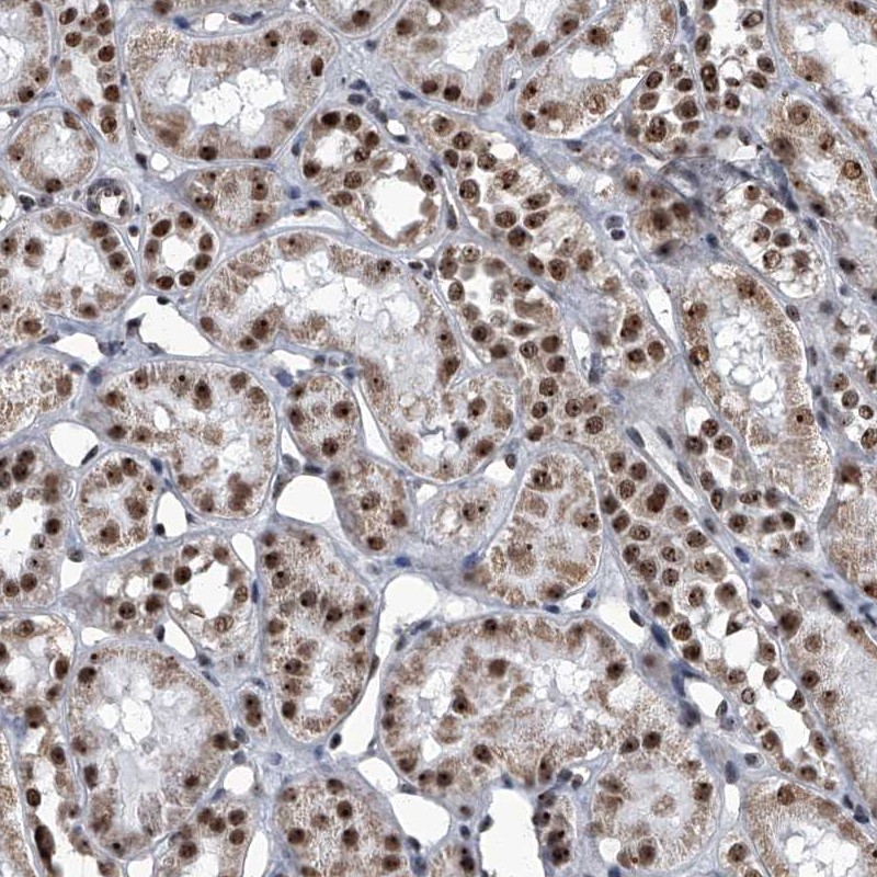 Anti-ZNF518B Antibody