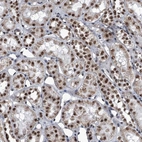 Anti-ZNF518B Antibody
