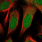 Immunofluorescent staining of human cell line U-2 OS shows localization to nucleus.