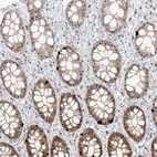 Immunohistochemical staining of human rectum shows strong positivity in nucleoli in glandular cells.