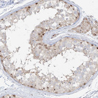 Immunohistochemical staining of human testis shows moderate positivity in nucleoli in cells in seminiferous ducts.