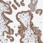 Immunohistochemical staining of human placenta shows strong positivity in nucleoli in trophoblastic cells.