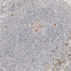 Immunohistochemical staining of human lymph node shows strong positivity in nucleoli in lymphoid cells.