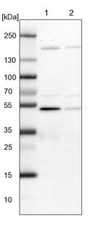 Lane 1: NIH-3T3 cell lysate (Mouse embryonic fibroblast cells)_br/_Lane 2: NBT-II cell lysate (Rat Wistar bladder tumour cells)