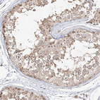 Immunohistochemical staining of human testis shows moderate positivity in nucleoli in cells in seminiferous ducts.