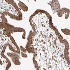 Immunohistochemical staining of human placenta shows strong positivity in nucleoli in trophoblastic cells.