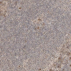 Immunohistochemical staining of human lymph node shows strong positivity in nucleoli in lymphoid cells.